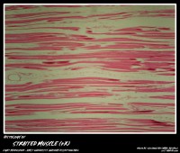 Histology Striated Muscle My Aimst University Lifestyle Blog