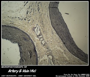 Micro-photograph of Artery VS Vein under Light Microscope magnification 4x
