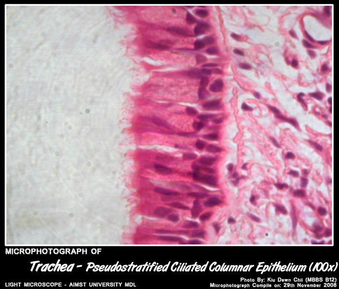 Histology of Respiratory system: Trachea | My Aimst University